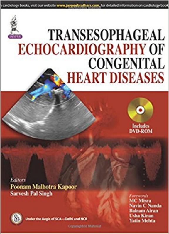 Buy Transesophageal Echocardiography Of Congenital Heart Diseases Book