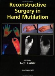 Reconstructive Surgery In Hand Mutilation
