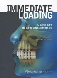 Immediate Loading: A New Era In Oral Implantology