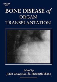 Bone Disease Of Organ Transplantation