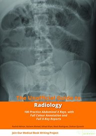 Unofficial Guide To Radiology : 100 Practice Abdominal X Rays With Full Colour Annotations