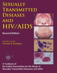 Sexually Transmitted Diseases & Aids