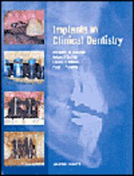 Implants In Clinical Dentistry