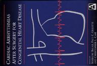 Cardiac Arrhythmias After Surgery For Congenital Heart Disease