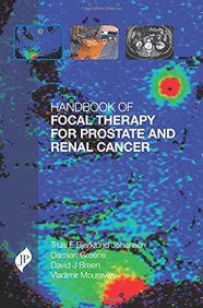 Handbook of Focal Therapy for Prostate and Renal Cancer