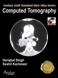 Buy Mini Atlas Of Ct Scan (Anshan Gold Standard Mini Atlas) book ...