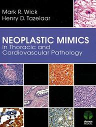 Neoplastic Mimics in Thoracic and Cardiovascular Pathology