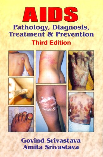 AIDS: Pathology, Diagnosis Treatment and Prevention