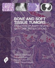 Bone and Soft Tissue Tumours