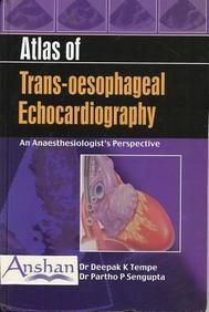 Atlas Of Trans-Oesophageal Echocardiography: An Anaesthesiologist's Perspective