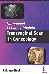 Ultrasound Teaching Module: Transvaginal Scan in Gynecology