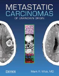 Metastatic Carcinomas Of Unknown Origin