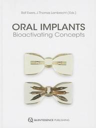Oral Implants: Bioactivating Concepts