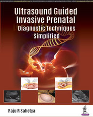 Ultrasound Guided Invasive Prenatal Diagnostic Techniques Simplified