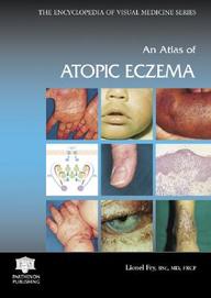 An Atlas Of Atopic Eczema (Encyclopedia Of Visual Medicine Series)
