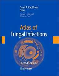 Atlas Of Fungal Infection