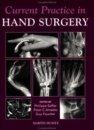 Current Practice In Hand Surgery