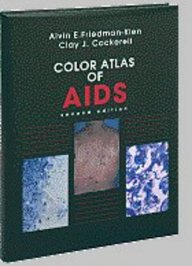 Color Atlas Of Aids