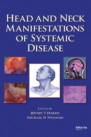 Head And Neck Manifestations Of Systemic Disease