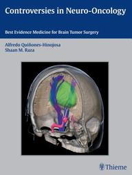 Controversies in Neuro-Oncology: Best Evidence for Brain Tumor Surgery