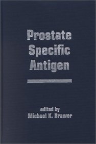 Prostate-Specific Antigen