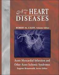 Atlas of Heart Diseases, Acute Myocardial Infarction and Other Acute Ischemic Syndromes, Second Edition (Atlas of Heart Diseases (Unnumbered).)