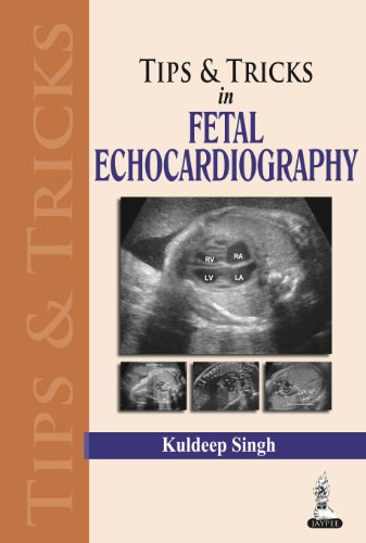 Tips & Tricks In Fetal Echocardiography