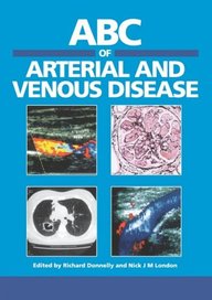 Abc Of Arterial And Venous Diseases (Abc Series)