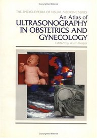 An Atlas Of Ultrasonography In Obstetrics And Gynecology - Visua