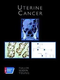 Uterine Cancer (American Cancer Society Atlas of Clinical Oncology)