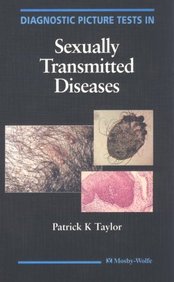 Diagnostic Picture Tests In Sexually Transmitted Diseases ( Out