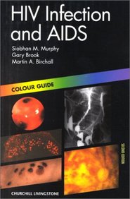 Hiv Infection And Aids: Colour Guide