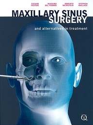 Maxillary Sinus Surgery And Alternatives In Treatment