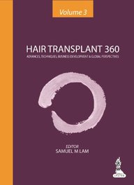 Hair Transplant 360