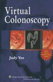 Virtual Colonoscopy