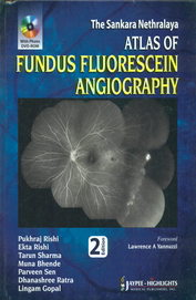 Sankara Nethralaya Atlas Of Fundus Fluorescein Angiography W/Dvd