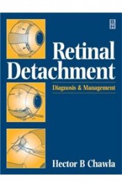 Retinal Detachment - The Essentials Of Management