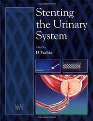 Stenting The Urinary System