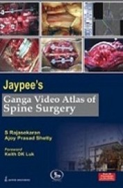 Ganga Video Atlas Of Spine Surgery W/6dvds