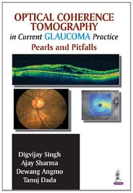 Buy Optical Coherence Tomography in Current Glaucoma Practice Pearls ...