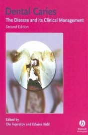 Dental Caries : The Disease & Its Clinical         Management