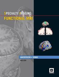 Specialty Imaging: Functional MRI: Published by Amirsys