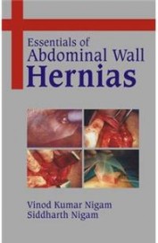 Buy Essentials Of Abdominal Wall Hernias Book Vinod Kumar Nigam Siddharth Nigam