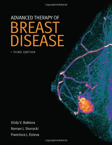 Advanced Therapy Of Breast Disease