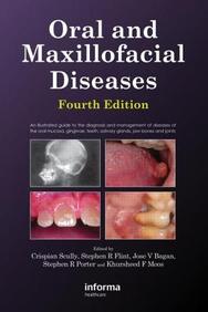 Oral And Maxillofacial Diseases, 4e