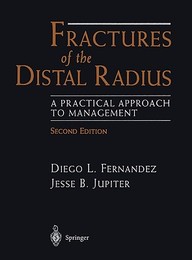 Fractures Of The Distal Radius : A Practical Approach To Managem