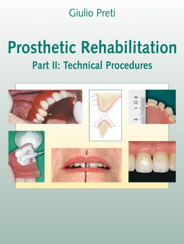 Prosthetic Rehabilitation: Technical Procedures