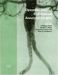Operative Atlas Of Endoluminal Aneurysm Surgery