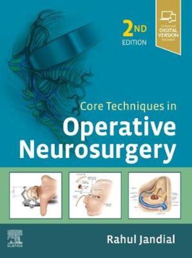 Core Techniques in Opertive Neurosurgery: 2nd edition