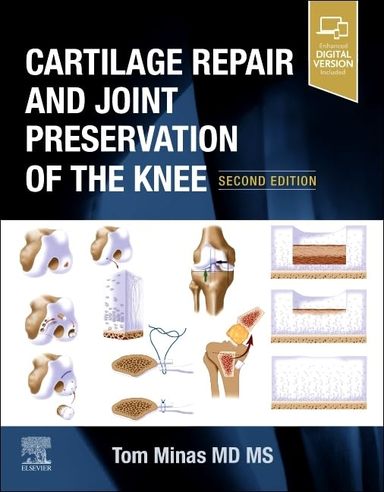Cartilage Repair and Joint Preservation of the Knee 2nd Edition